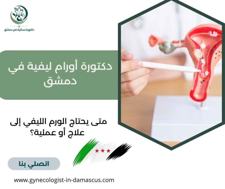 دكتورة أورام ليفية في دمشق