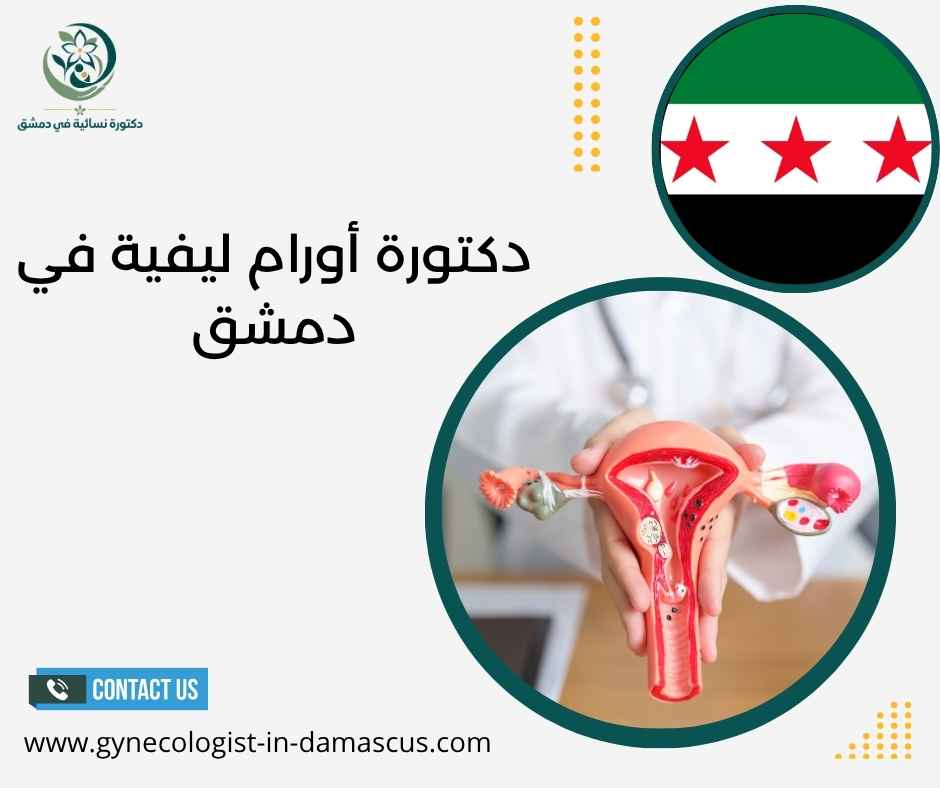 دكتورة أورام ليفية في دمشق