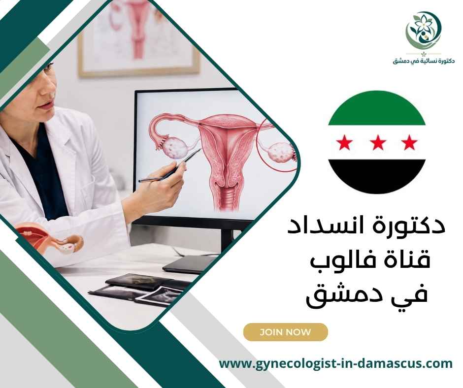 دكتورة انسداد قناة فالوب في دمشق