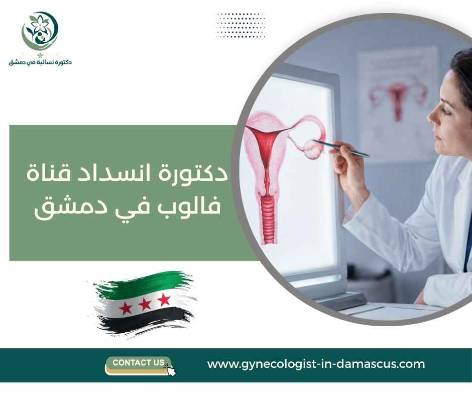 دكتورة انسداد قناة فالوب في دمشق