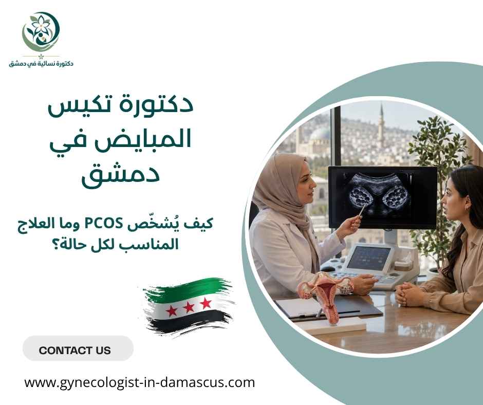 دكتورة تكيس المبايض في دمشق