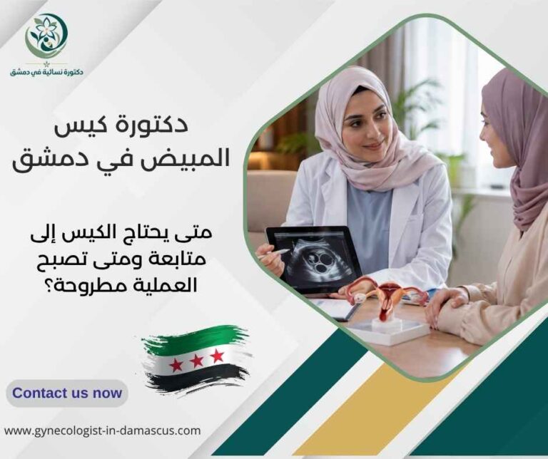 دكتورة كيس المبيض في دمشق