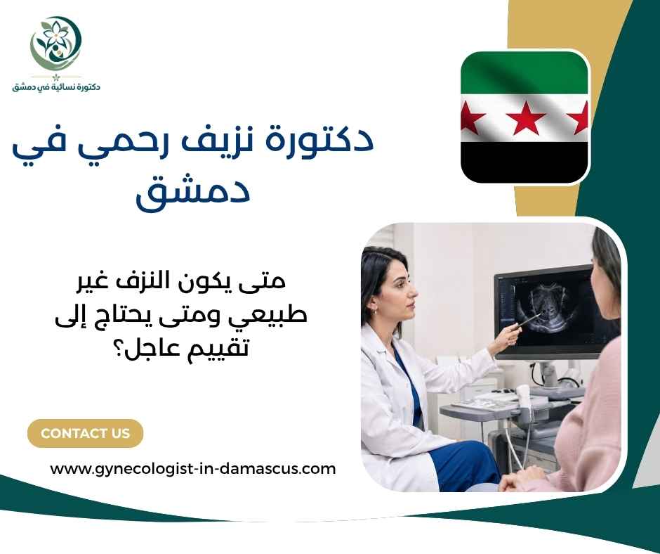 دكتورة نزيف رحمي في دمشق