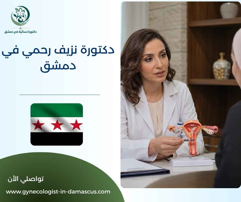 دكتورة نزيف رحمي في دمشق