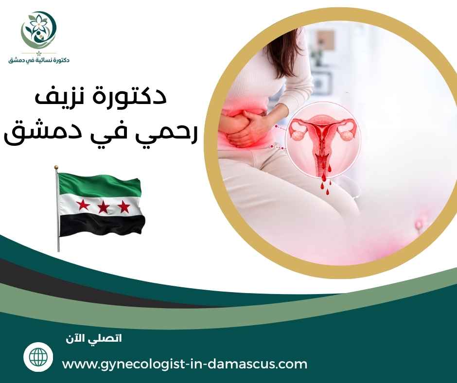 دكتورة نزيف رحمي في دمشق