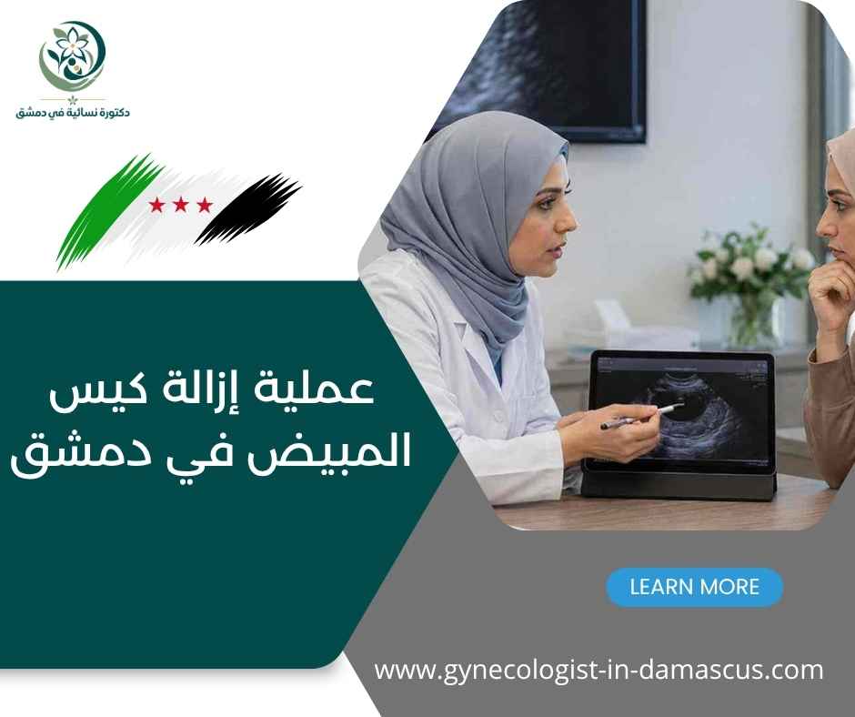 عملية إزالة كيس المبيض في دمشق عملية إزالة كيس المبيض في دمشق
