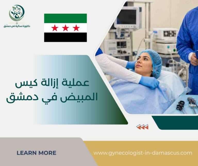 عملية إزالة كيس المبيض في دمشق