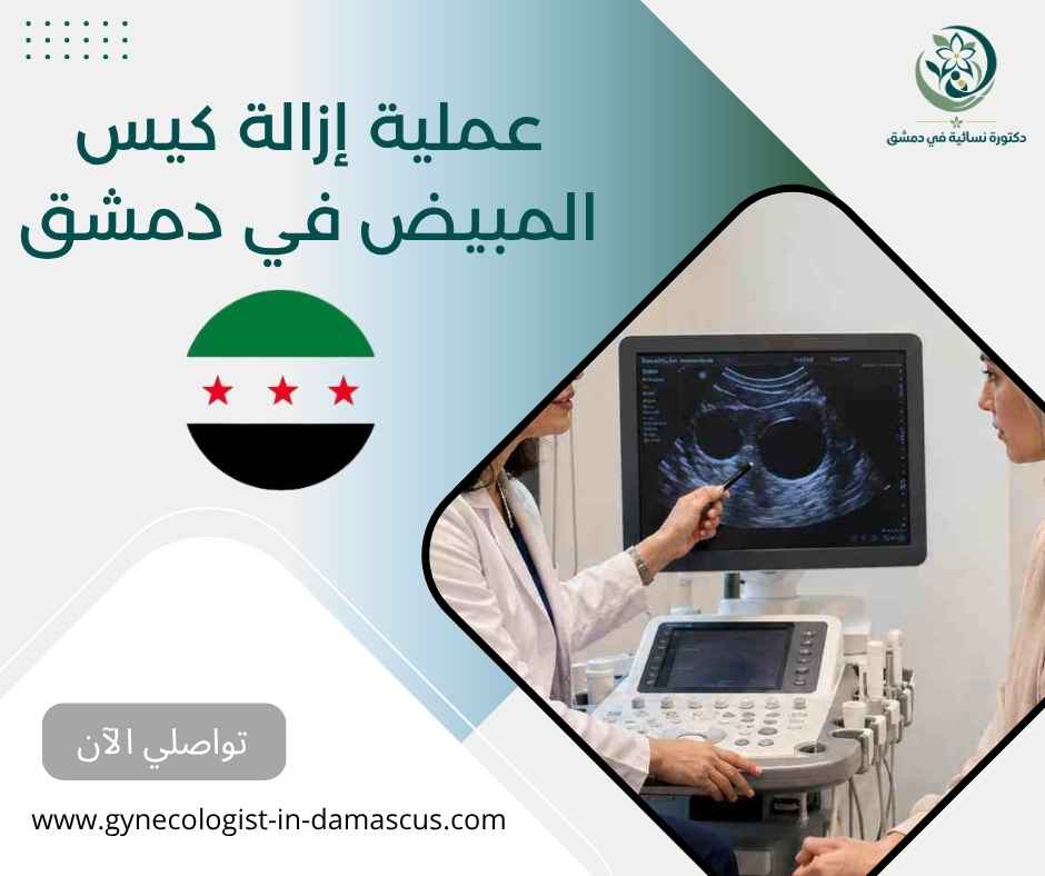 عملية إزالة كيس المبيض في دمشق عملية إزالة كيس المبيض في دمشق