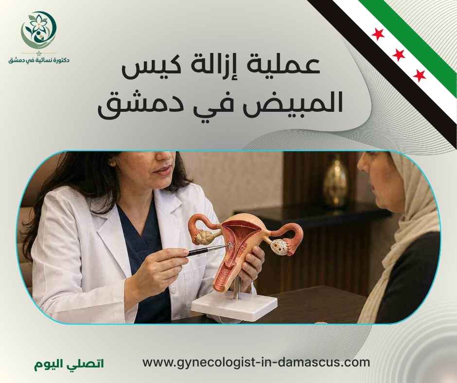 عملية إزالة كيس المبيض في دمشق