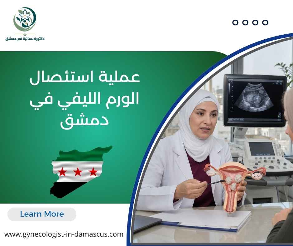 عملية استئصال الورم الليفي في دمشق