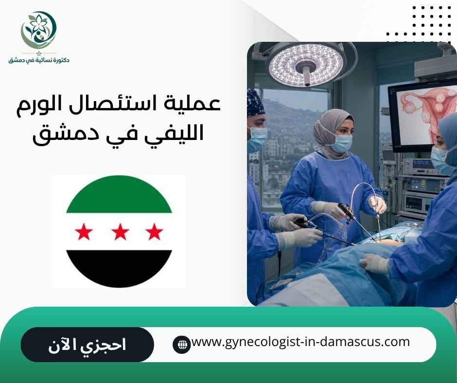 عملية استئصال الورم الليفي في دمشق