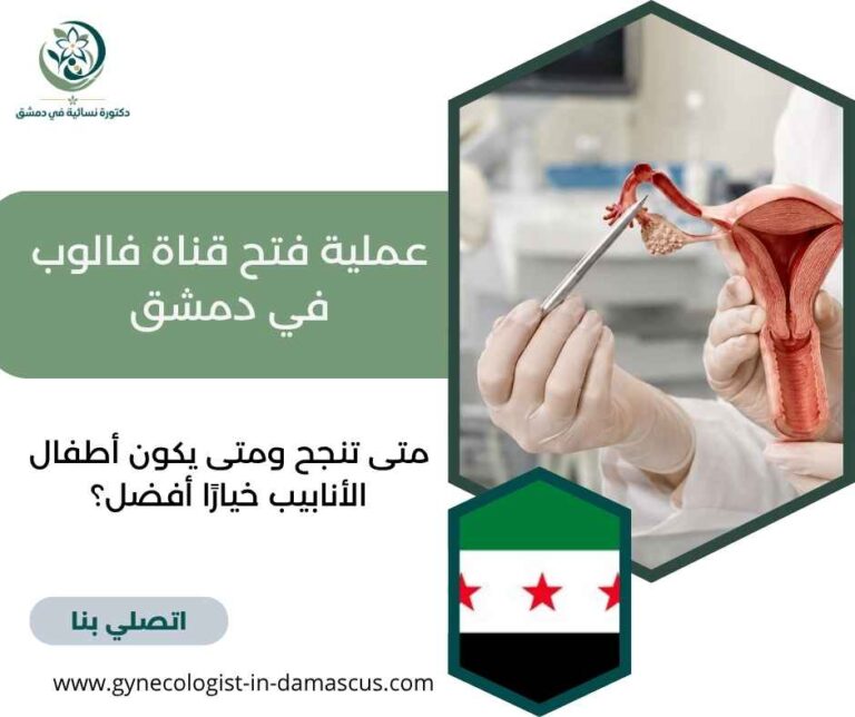 عملية فتح قناة فالوب في دمشق