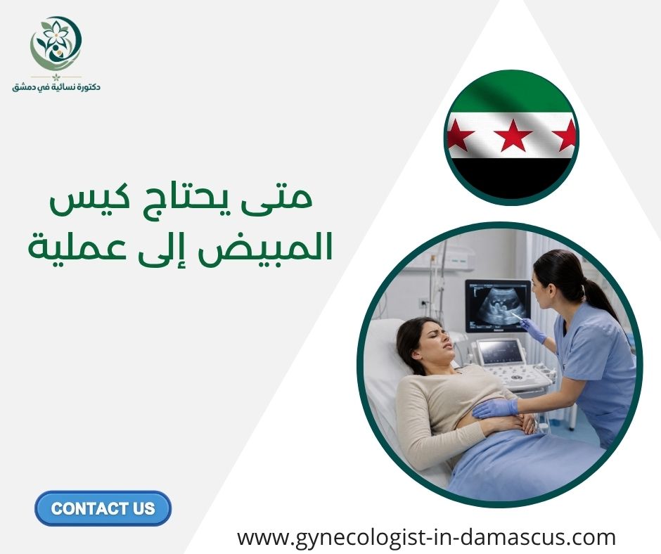 متى يحتاج كيس المبيض إلى عملية